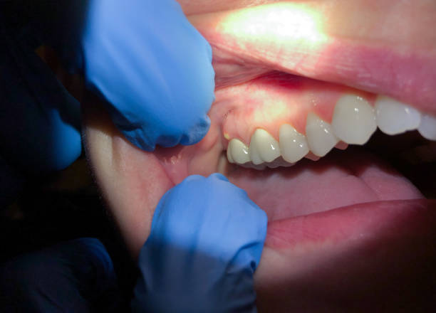 Best Holiday Emergency Dentist in Stonebridge, NJ