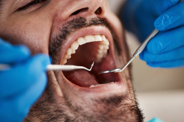 Best Pediatric Emergency Dentist in Stonebridge, NJ